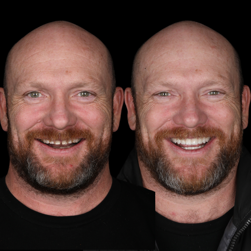 digital smile design