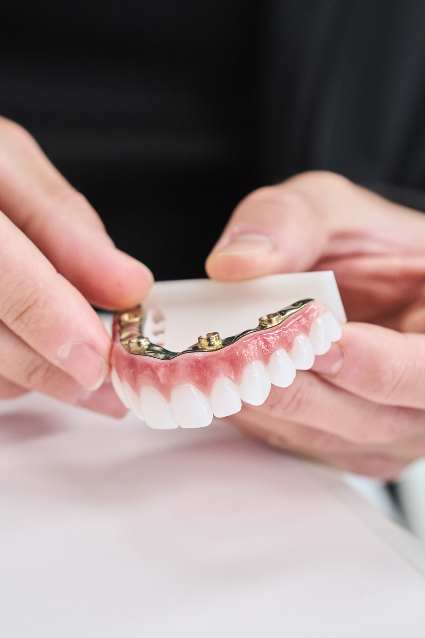 All on 4 Dental Implants Final Restoration
